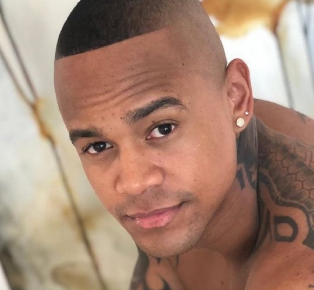 [Léo Santana vai recorrer a implante capilar, diz colunista]