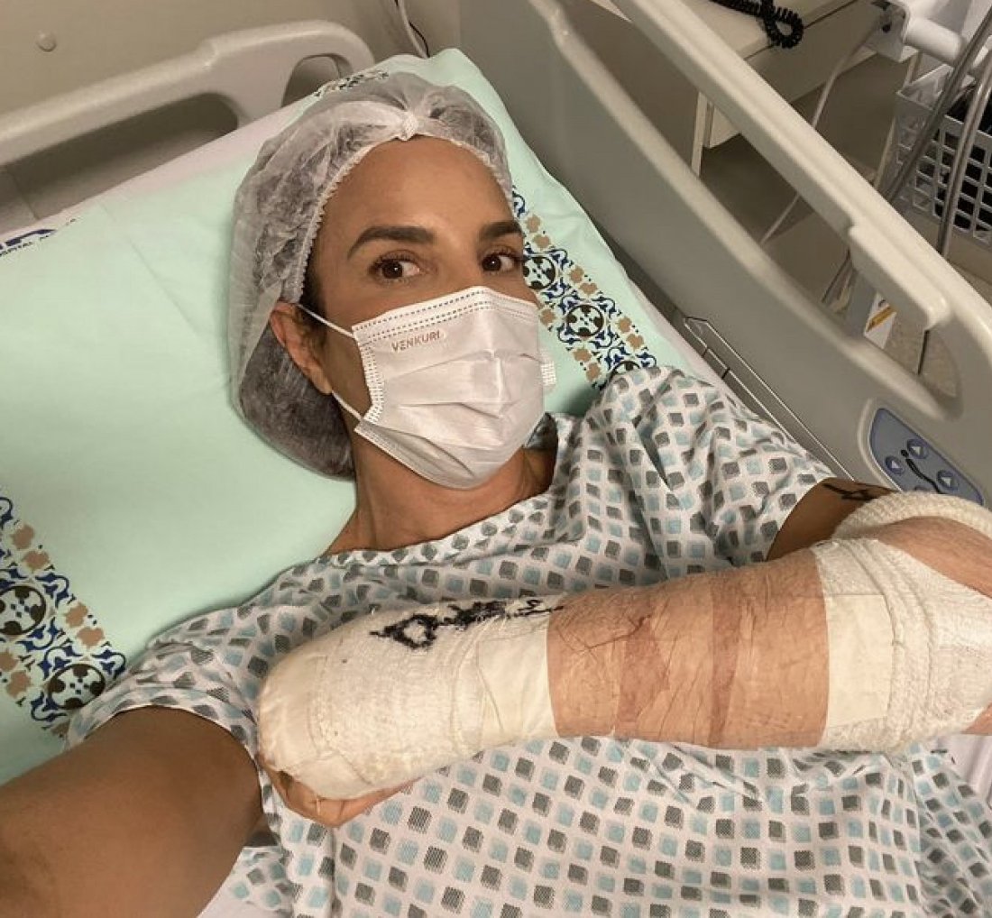 Ivete Sangalo tranquiliza os fãs após a cirurgia: [Ivete Sangalo tranquiliza os fãs após a cirurgia: