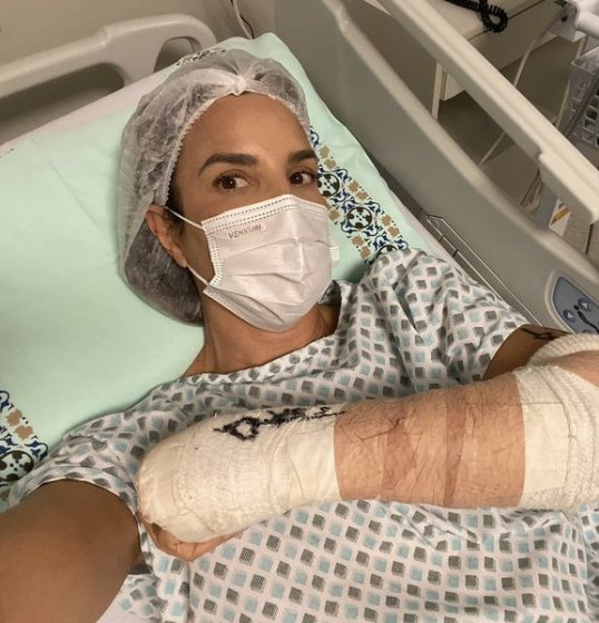 Ivete Sangalo tranquiliza os fãs após a cirurgia: Ivete Sangalo tranquiliza os fãs após a cirurgia: